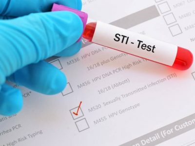 cybh testi