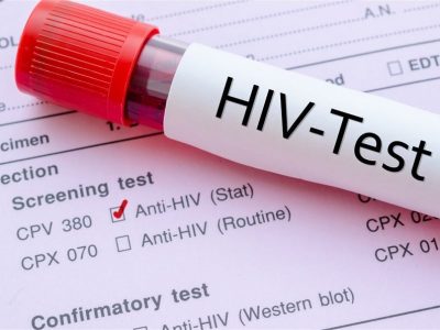 hiv testi