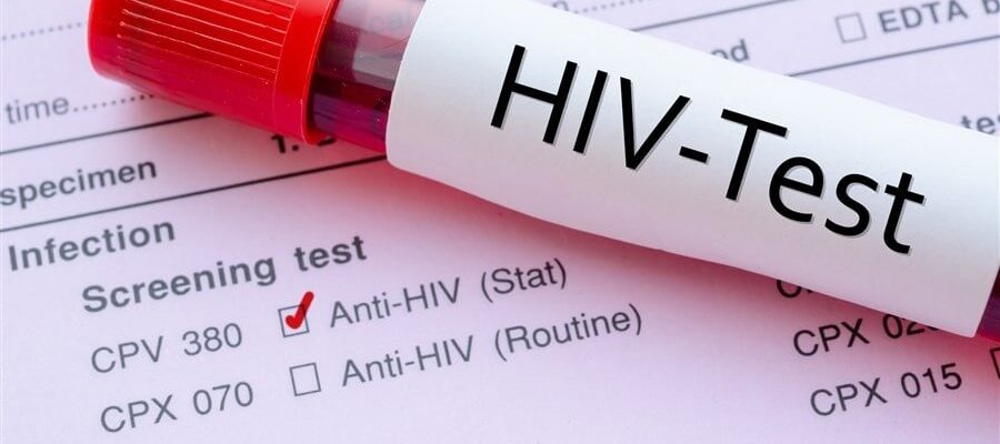 hiv testi