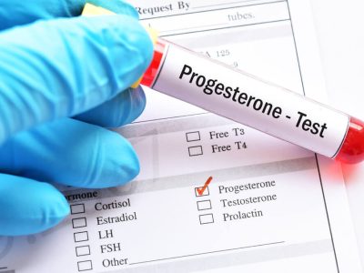progesteron testi
