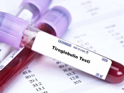 tiroglobulin testi