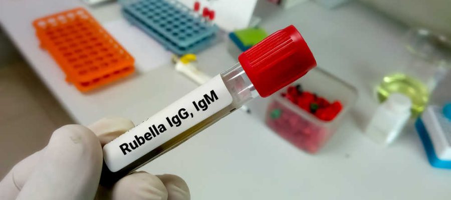 rubella igg testi